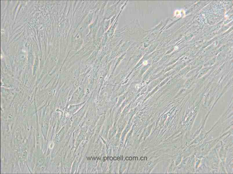 CCD-1095Sk (人乳腺浸潤(rùn)性導(dǎo)管癌旁皮膚細(xì)胞) (STR鑒定正確)