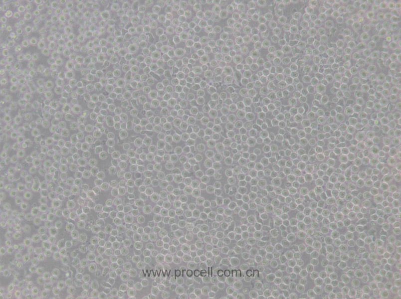 CCRF-CEM [CCRF CEM] (人急性淋巴細胞白血病T淋巴細胞) (STR鑒定正確)