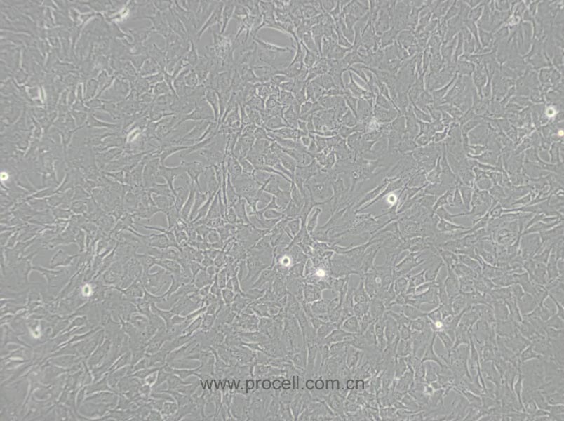 SW579 [SW 579; SW-579] (人甲狀腺鱗癌細(xì)胞) (STR鑒定正確)