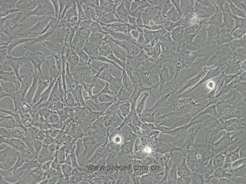 SW579 [SW 579; SW-579] (人甲狀腺鱗癌細(xì)胞) (STR鑒定正確)