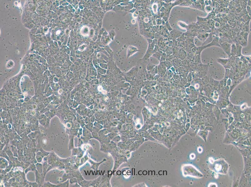 UPCI-SCC-090（人舌鱗癌細(xì)胞）（STR鑒定正確）