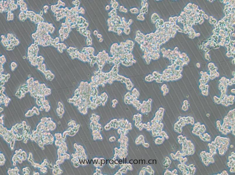 HCC1187（人乳腺導(dǎo)管癌細(xì)胞）（STR鑒定正確）
