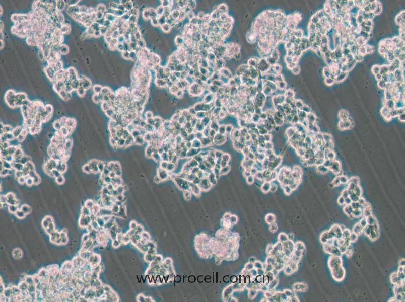 HCC1187（人乳腺導(dǎo)管癌細(xì)胞）（STR鑒定正確）