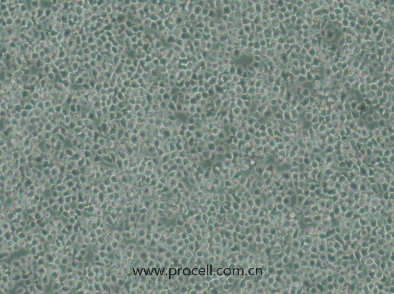 C1498-LUC (熒光素酶標記的小鼠白血病細胞) (種屬鑒定正確)