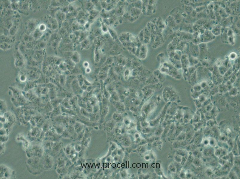 QGP-1 (人胰腺癌細胞) (STR鑒定正確)