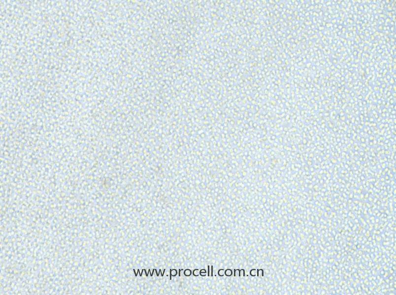 OCI-AML-2 (人急性髓性白血病細胞) (STR鑒定正確)