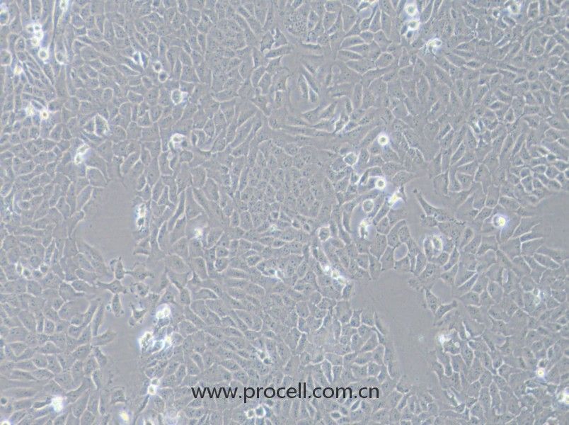 143B（人骨肉瘤細(xì)胞）（STR鑒定正確）