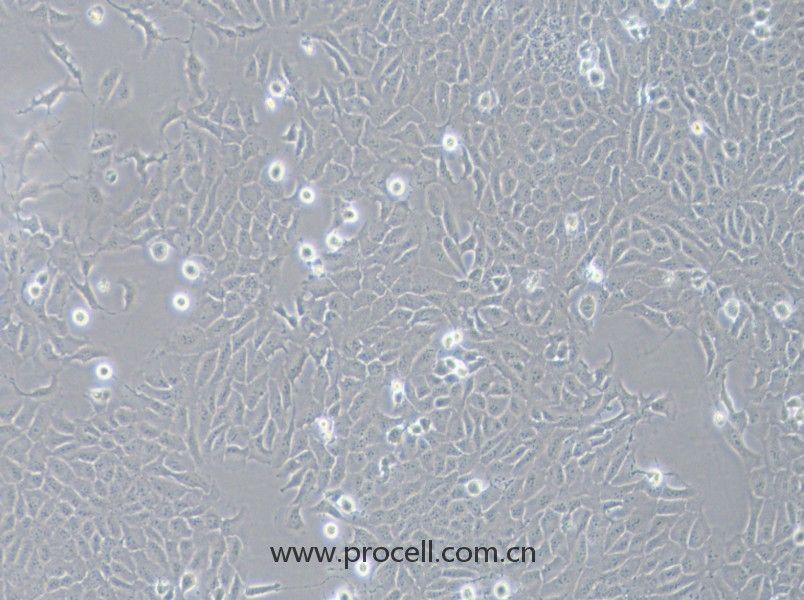 143B（人骨肉瘤細(xì)胞）（STR鑒定正確）