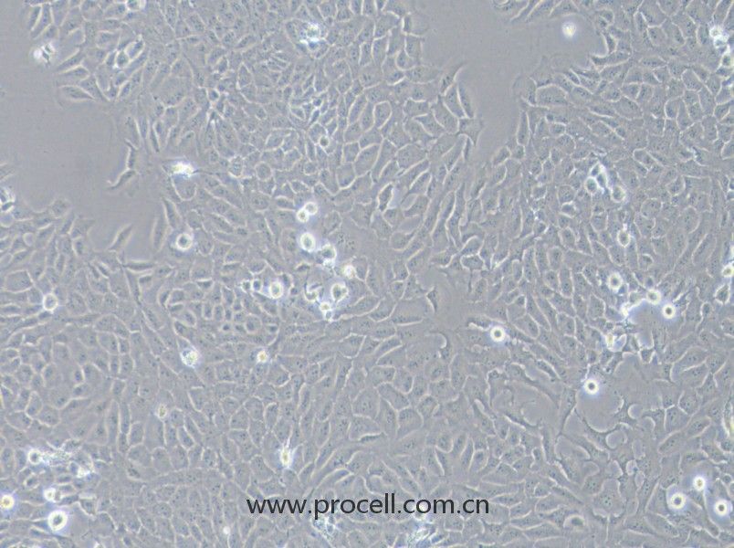 143B（人骨肉瘤細(xì)胞）（STR鑒定正確）