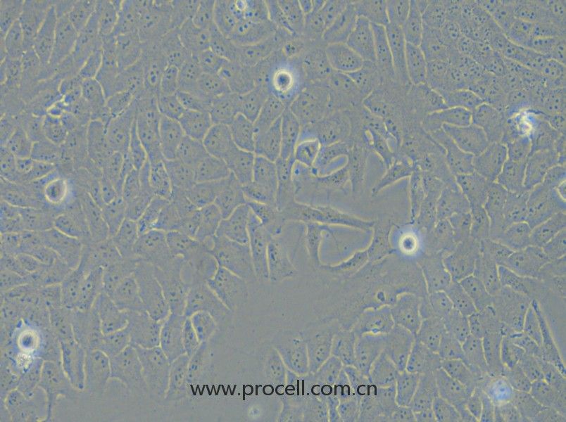 143B（人骨肉瘤細(xì)胞）（STR鑒定正確）