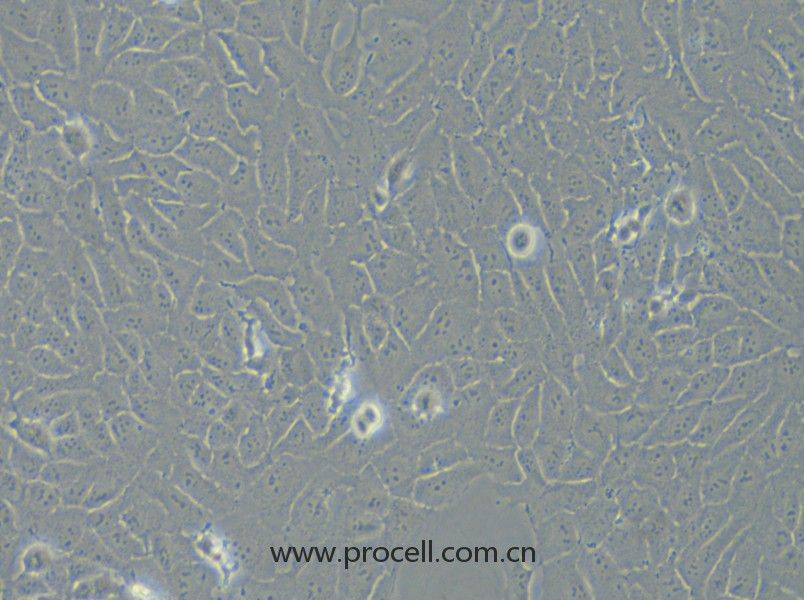 143B（人骨肉瘤細(xì)胞）（STR鑒定正確）